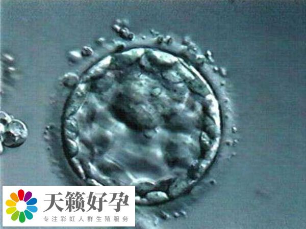 試管嬰兒(er) 優(you) 胚的成功率比較高