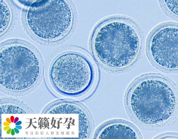 精卵質量是影響試管嬰兒(er) 成功率的因素之一