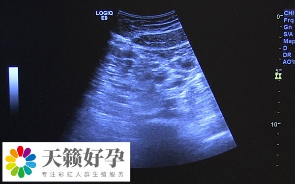 卵泡大於(yu) 18打夜針最好