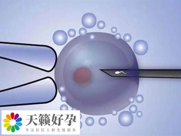 養(yang) 囊有一定優(you) 勢