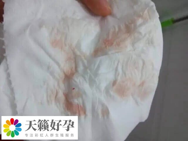 試管移植後出血要注意觀察