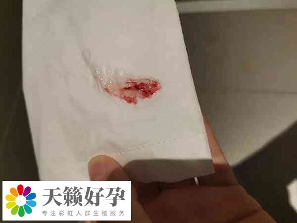 試管移植後出血是著床出血