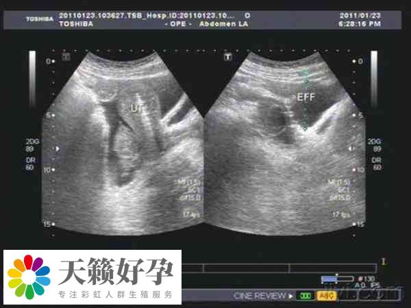 促排數量多有助於(yu) 提高成功率