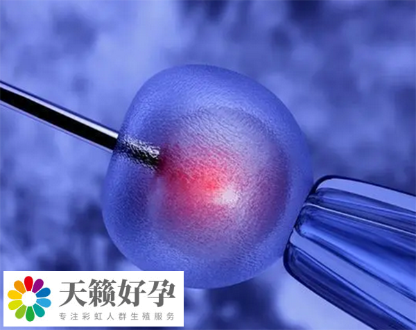 人工授精失敗轉試管要做手術