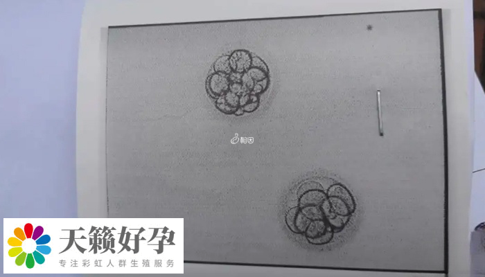 移植凍胚和自然懷孕測出時間不一樣