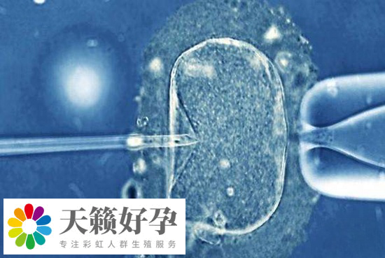 高齡女性可以去泰國做試管