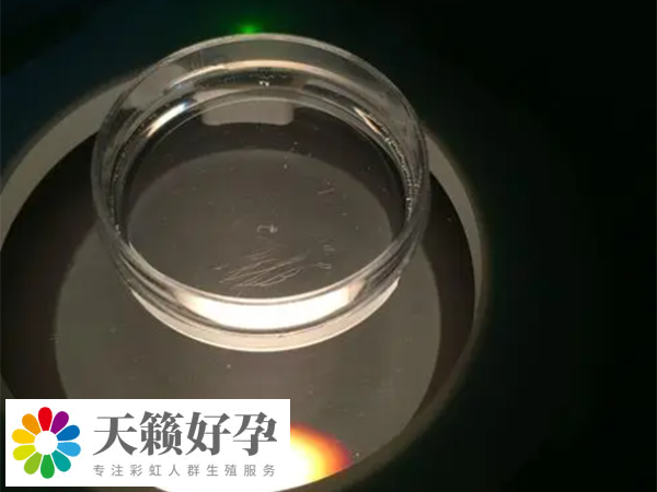 供精不是必須做顯微鏡檢查