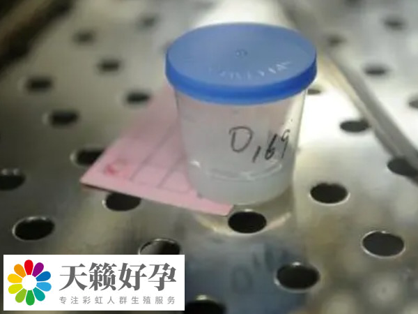 供精不是必須要血型一致