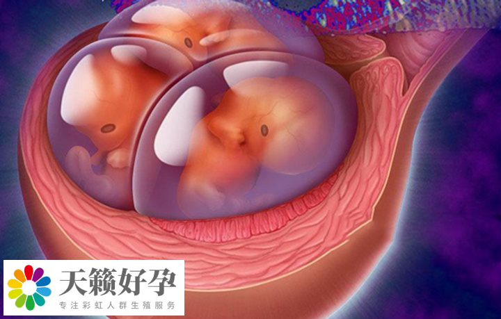 植入多個(ge) 胚胎可能會(hui) 導致多胎妊娠