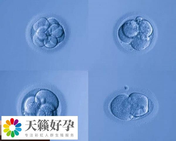 養(yang) 囊可以提高試管移植成功率