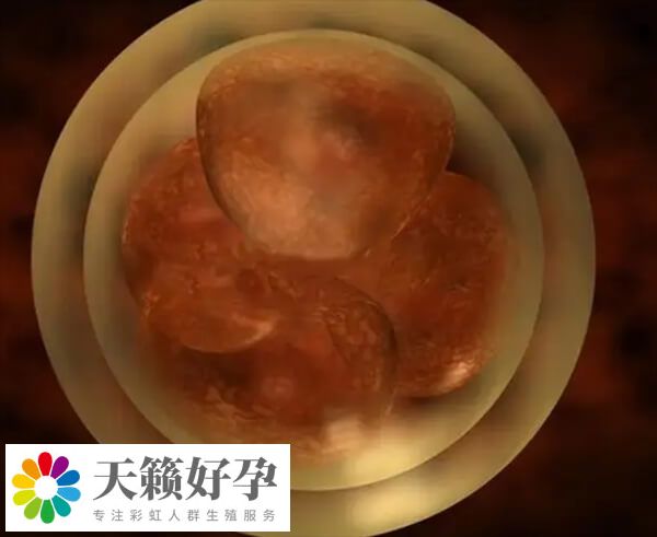 肥胖對試管有什麽影響