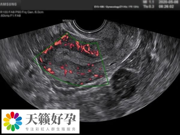 男性需要進行睾丸超聲檢查