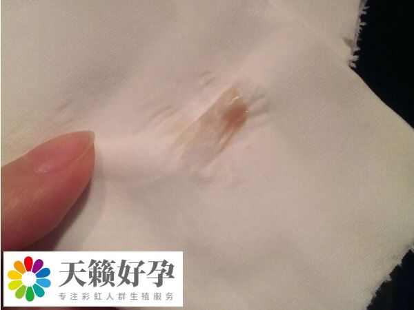 試管移植後胸脹疼可能是懷孕了