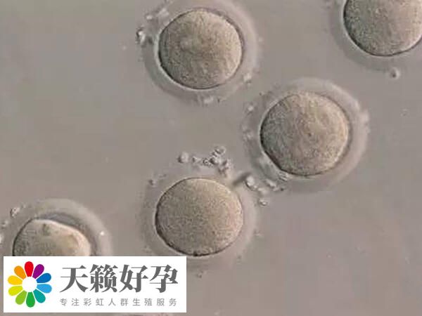 鮮胚移植和凍胚移植成功率都差不多