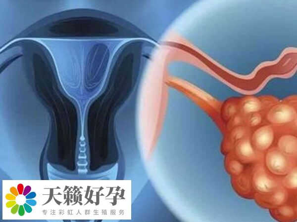 取卵後肚子痛可能是感染