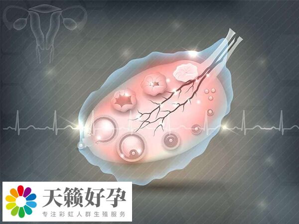 取卵後腹痛可能是卵巢刺激
