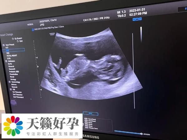 <a href=https://www.nzzt.cn/topic/337.html target=_blank class=infotextkey>冷凍<a href=https://www.nzzt.cn/topic/246.html target=_blank class=infotextkey>胚胎</a></a>移植需要在特定條件的情況下進行