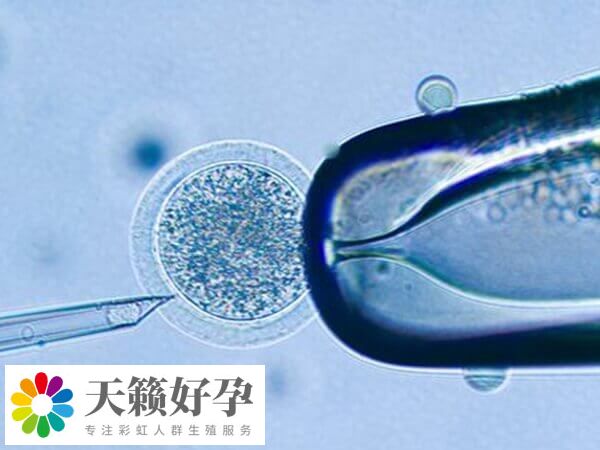 卵泡27*21是偏大的