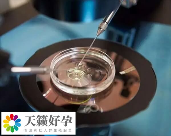 俄羅斯有三代試管胚胎全染色體(ti) 篩查